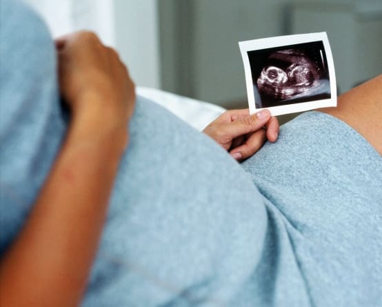 wondering the gender of baby, a pregnant woman's hand holding an ultrasound picture of the baby