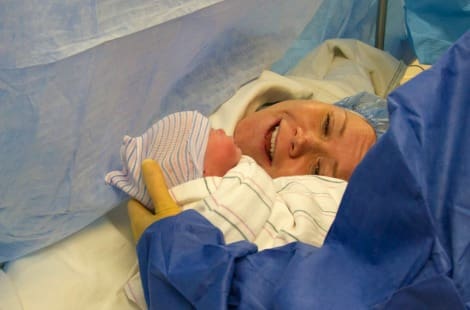 Learn what you need to know about giving birth by C-section!