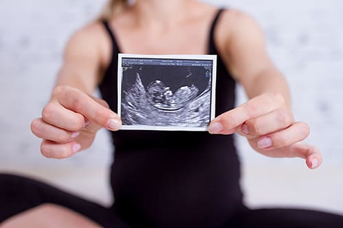 Pregnant woman holds ultrasound photo, after learning about fetal development week-by-week